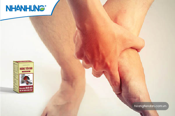 Cách chữa bệnh gout cấp an toàn tại nhà