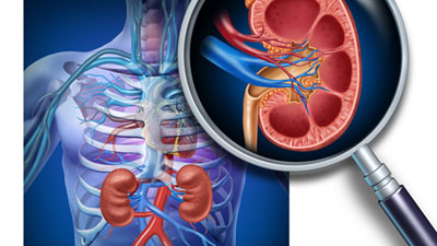 Thận suy yếu - con đường mắc bệnh gút ngắn nhất