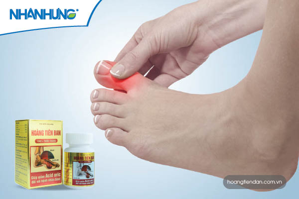 Dấu hiệu ban đầu của bệnh gout là sưng nóng, đỏ đau ngón chân cái