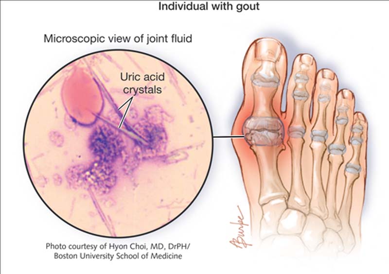 thành phần, hoạt động của acid uric