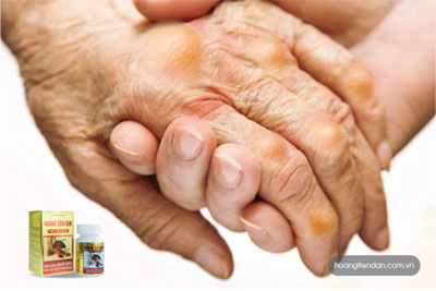 Suy giảm chức năng thận gây ra bệnh gút