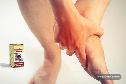 Hoàng Tiên Đan – Tiêu tan nỗi lo bệnh gút