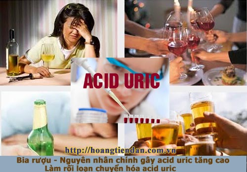 Rượu bia, đồ uống có cồn - nguyên nhân hàng đầu gây ra bệnh gout