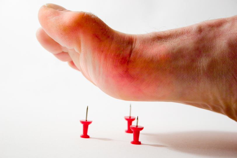 Sưng, tấy đỏ, đau các khớp là dấu hiệu đặc trưng của gout