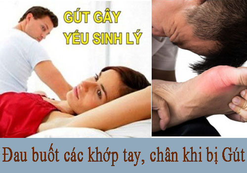 Bệnh gout gây yếu sinh lý