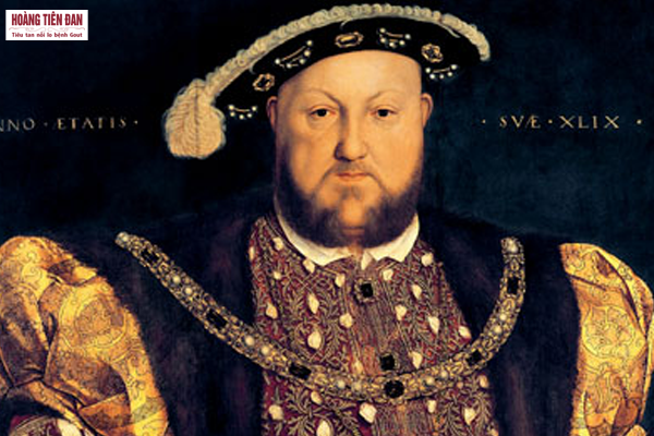 Những người nổi tiếng bị mắc bệnh gút