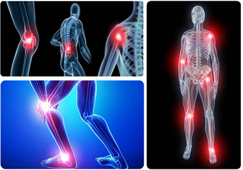  Nhiều người lầm tưởng bệnh giả gout là gout