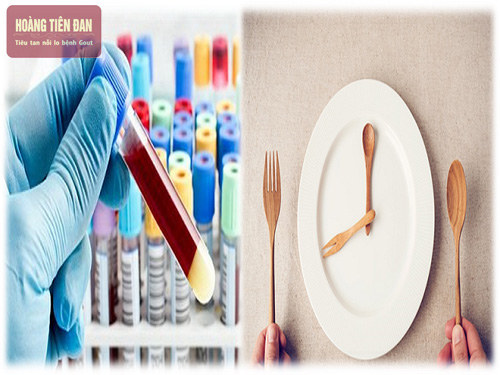Ăn rồi có xét nghiệm máu được không là câu hỏi của rất nhiều người