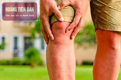 Đau khớp gối có thể do các nguyên nhân cơ học