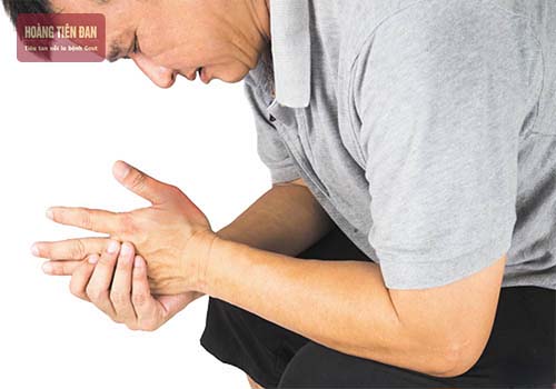 Cải thiện bệnh gout bằng cách giảm lượng thức ăn chứa acid uric