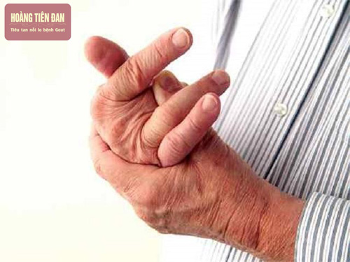 Sử dụng cà phê đúng liều lượng mỗi ngày giúp giảm triệu chứng bệnh gout