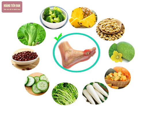 Xây dựng chế độ ăn hợp lý cho người bệnh gút