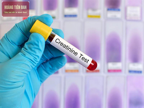 Xét nghiệm độ lọc cầu thận sẽ giúp chẩn đoán bệnh suy thận