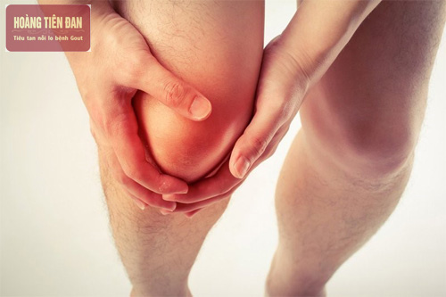 Bệnh gout ở đầu gối sẽ gây ra những cơn đau dữ dội