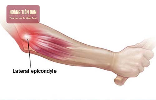 Cấu trúc khớp khuỷu tay