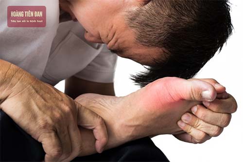 Bệnh gout gây đau đơn các khớp xương