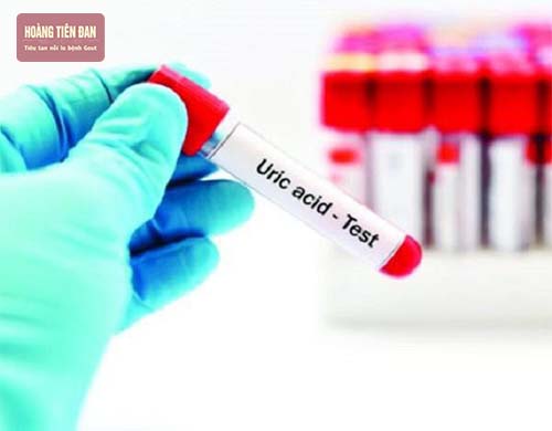 Giảm nồng độ acid uric trước khi tìm cách đào thải tinh thể muối urat