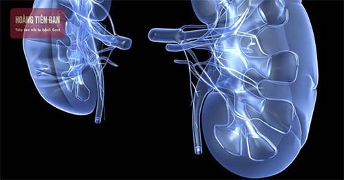 Bệnh gout ở cổ tay còn có thể ảnh hưởng đến chức năng thận