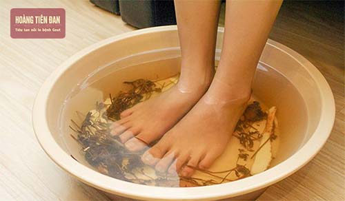 Ngâm chân với lá nốt hoặc lá trầu không giúp giảm đau gout cấp hiệu quả