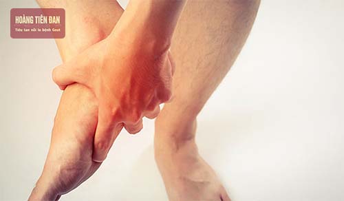 Cơn đau gout kéo dài bao lâu