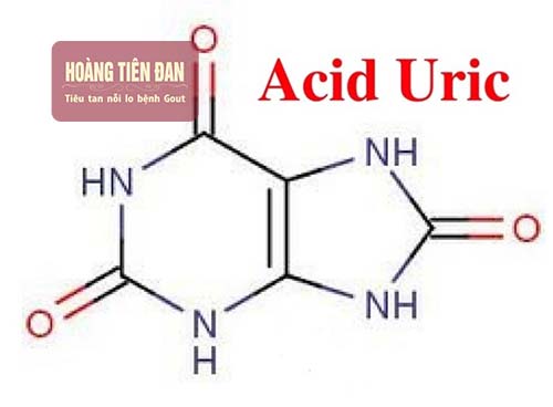 Chỉ số acid uric trong máu cao có phải bệnh gout