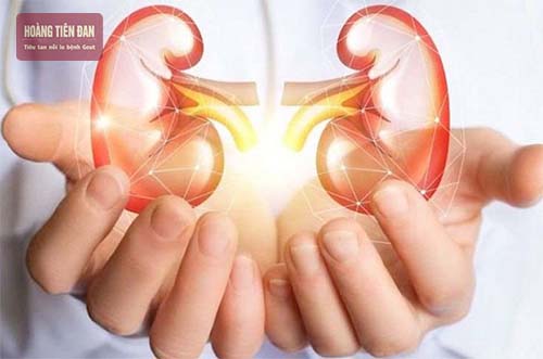 Nồng độ acid uric cao có thể dẫn đến các bệnh thận mãn tính