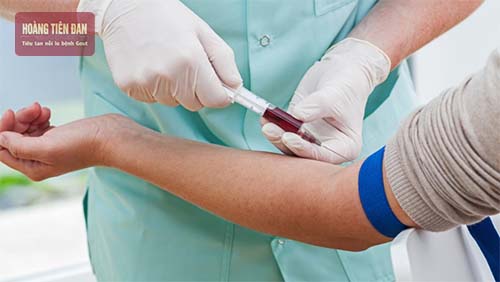 Khi có các dấu hiệu bệnh gout ở tay người bệnh cần đến thăm khám bác sĩ