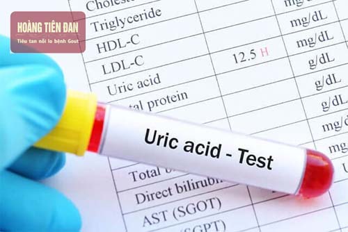 Tác dụng của acid uric đối với cơ thể