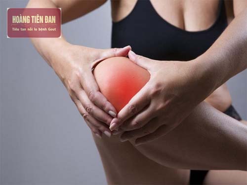  Có nhiều phương pháp để điều trị acid uric trên đầu gối