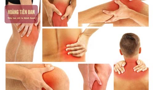 Có rất nhiều loại bệnh viêm khớp và mỗi loại có nguyên nhân khác nhau