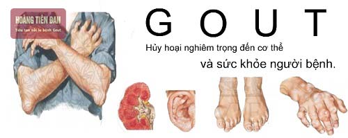 Bệnh gout ăn được mực không