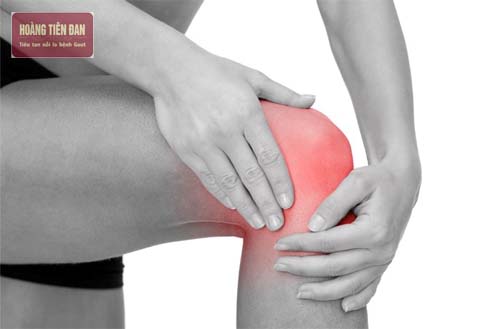   Gout thường gây ra các cơn đau nhức khớp dữ dội.