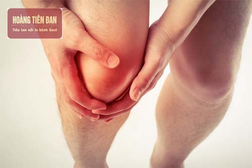 Gout Đầu Gối: Nguyên Nhân, Triệu Chứng và Cách Điều Trị Hiệu Quả