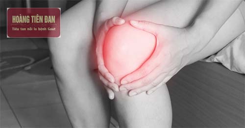 Những người bị bệnh gout ở đầu gối thường có các cơn đau về đêm