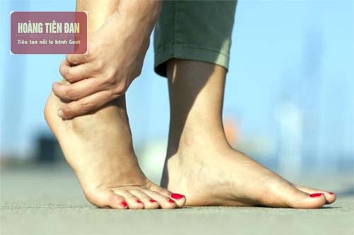   Bệnh gout thứ phát cũng gây ra các cơn đau dữ dội