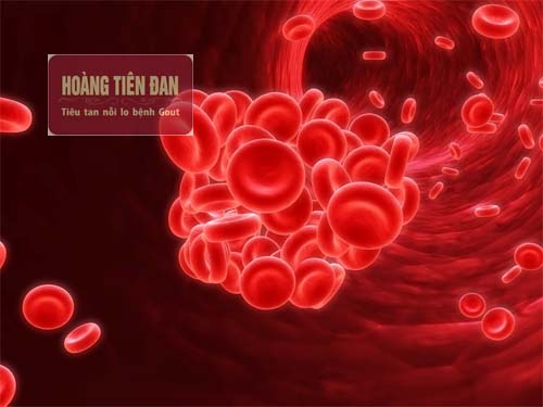  Bệnh gout thứ phát có thể xuất hiện sau một số bệnh về máu
