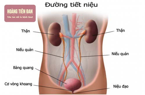  Nhiễm trùng toàn bộ đường tiết niệu do sỏi thận.