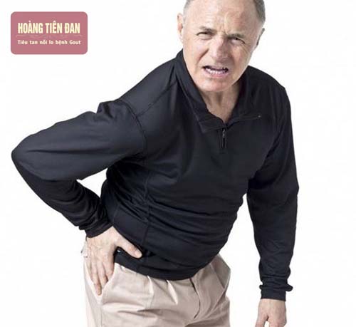   Người bệnh sẽ thường xuyên gặp các cơn đau khi bị thoái hóa khớp háng