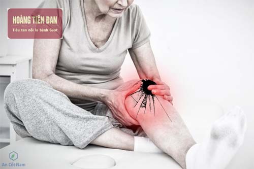 Thoái hóa khớp cũng rất dễ nhầm lẫn với bệnh gout.