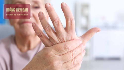 Viêm khớp dạng thấp là một trong các bệnh dễ nhầm lẫn với gout.