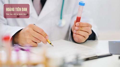 Chỉ số acid uric 500 là một chỉ số cao.