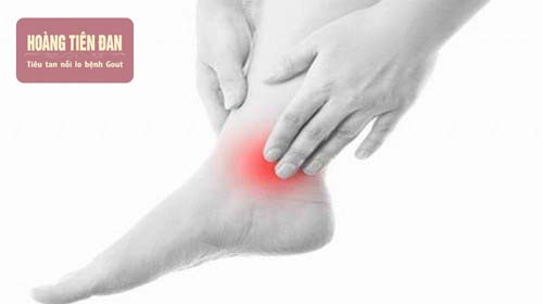 Đau khớp cổ chân sẽ nghiêm trọng hơn khi đi bộ hay vận động mạnh.