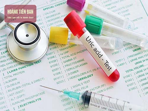   Nồng độ acid uric máu 520mmol/l biểu hiện cho người đã bị bệnh gout