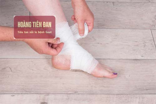  Cố định mắt cá chân làm giảm cơn đau hiệu quả.