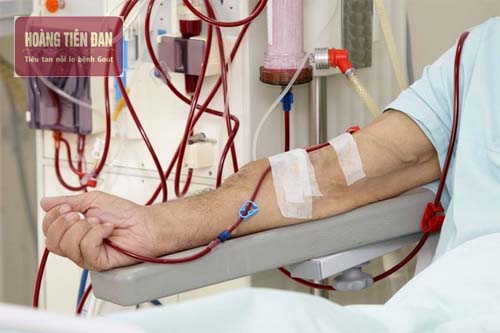 Phương pháp điều trị tối ưu cho người bị suy thận độ 4.