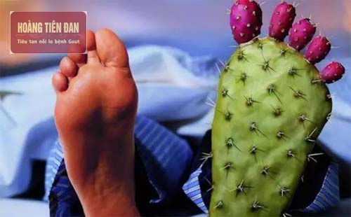 Những cơn đau gout cấp thường xuất hiện vào ban đêm do nhiều nguyên nhân.