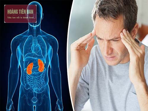 Acid uric tăng cao có thể gây ra các bệnh lý về thận