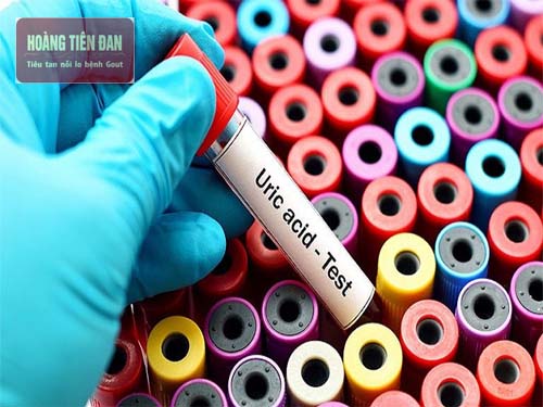 Acid uric được hình thành từ quá trình thoái hóa nhân purin