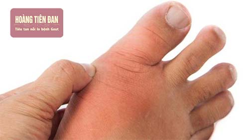 Massage ngón chân cái nhẹ nhàng để giảm đau