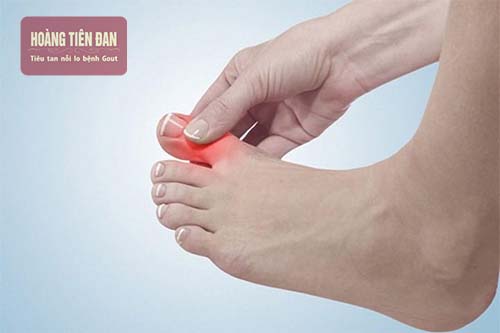 Có nhiều nguyên nhân dẫn đến ngón chân cái bị sưng đau